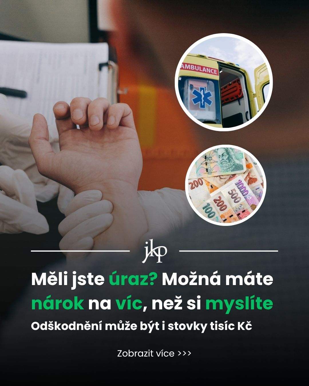 odškodnění po úrazu výpočet bodů a hodnota bodu 2026